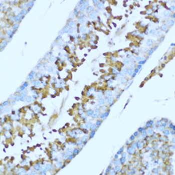 Anti HPX Hemopexin Antibody ARG59569 Arigo Biolaboratories