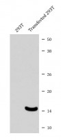 Anti Alpha Synuclein Phospho Ser129 Antibody ARG40582 Arigo