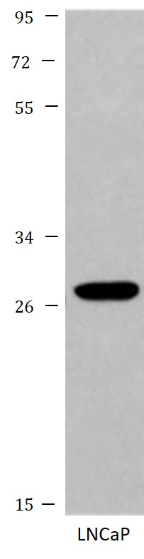 Western blot: LNCaP cell lysate stained with ARG43744 anti-FGF8 antibody.