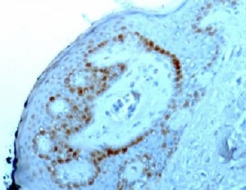 Immunohistochemistry: Formalin-fixed and paraffin-embedded Human skin stained with ARG56180 anti-Nucleoli Marker antibody [NM95].