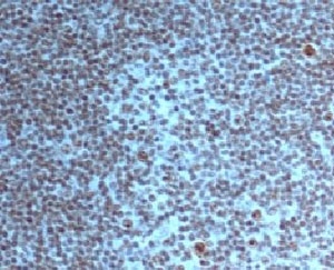 Immunohistochemistry: Formalin-fixed and paraffin-embedded Human tonsil tissue stained with ARG56180 anti-Nucleoli Marker antibody [NM95].