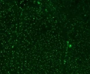 Immunohistochemistry: Formalin-fixed and paraffin-embedded colon carcinoma stained with Alexa Fluor 488-conjugated ARG56180 anti-Nucleoli Marker antibody [NM95].