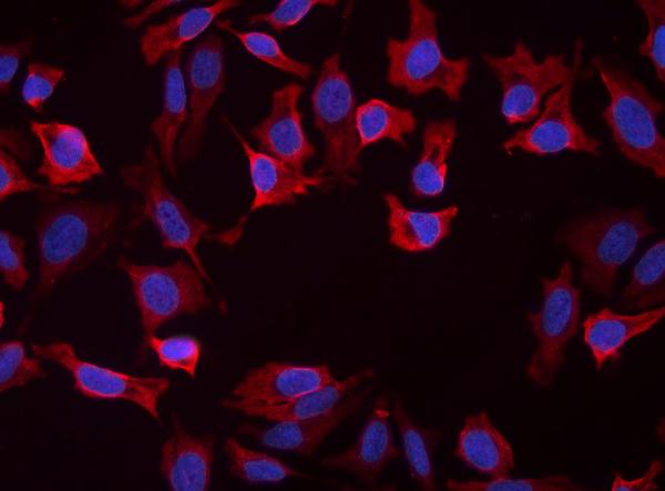 anti-SLC25A1 antibody (ARG42971) - arigo Biolaboratories