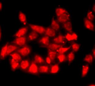 Immunofluorescence: MCF7 cells stained with ARG43318 anti-TEM8 / Anthrax Toxin Receptor 1 antibody.