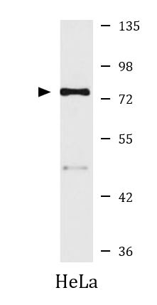 Western blot: 25 microg of HeLa cell lysate stained with ARG43318 anti-TEM8 / Anthrax Toxin Receptor 1 antibody at 1:1000 dilution.