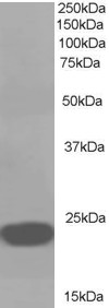 Western blot: 35 microg of A549 cell lysate (in RIPA buffer) stained with ARG63444 anti-PEBP1 / RKIP antibody at 1 microg/ml dilution and incubated at RT for 1 hour.