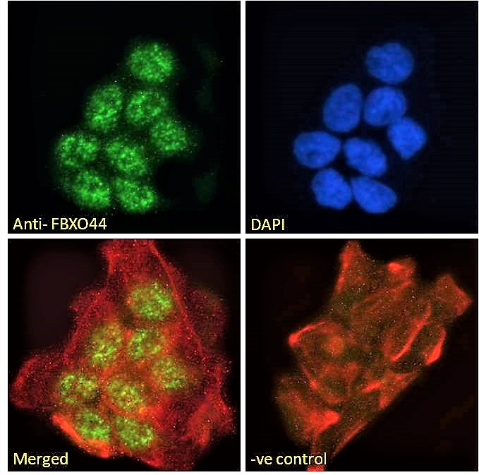 Immunofluorescence: Paraformaldehyde fixed A431 cells permeabilized with 0.15% Triton. Cells were stained with ARG63585 anti-FBXO44 antibody (green) at 10 microg/ml dilution for 1 hour. DAPI (blue) for nuclear staining. Phalloidin (red) for Actin filaments staining. Negative control: Unimmunized goat IgG (green) at 10 microg/ml dilution.