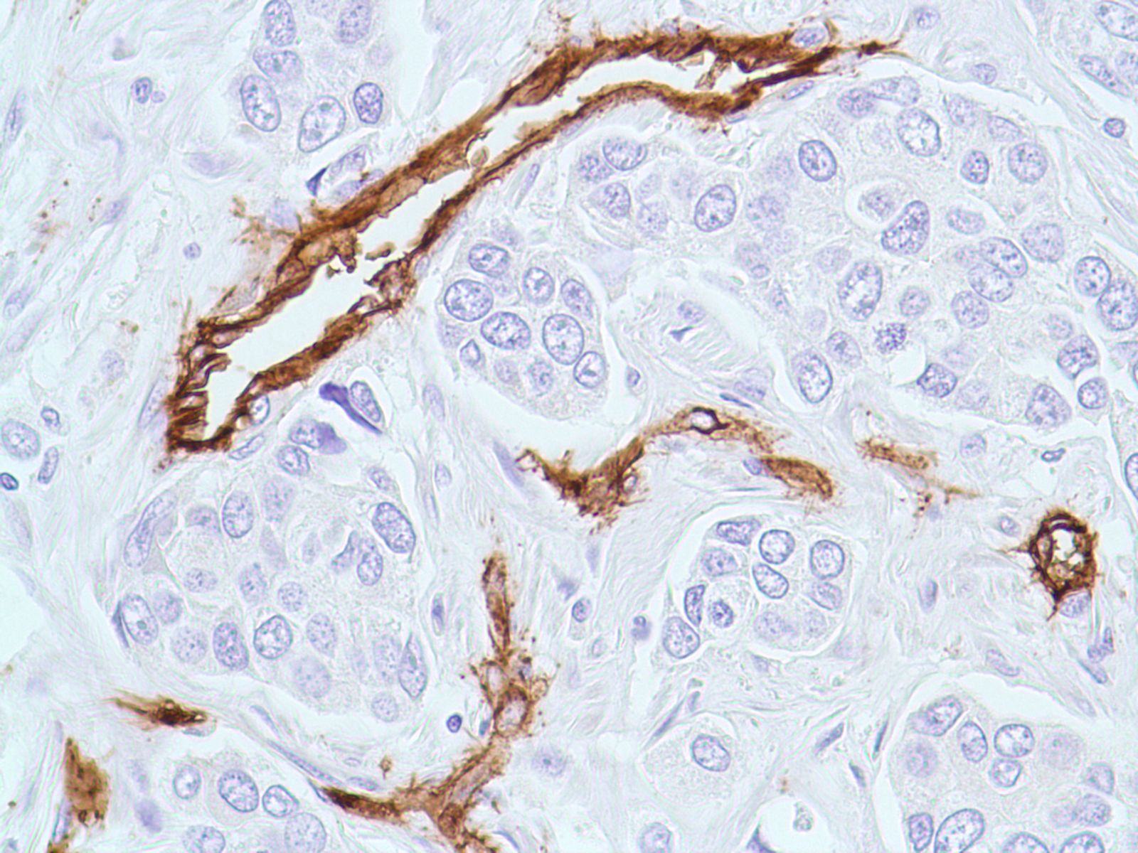 ARG52756anti-CD34 antibody [QBEND/10]