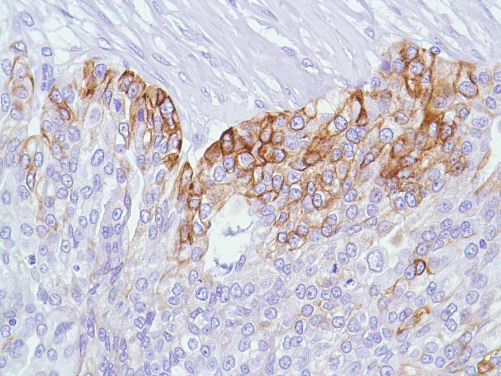 anti-Cytokeratin 14 antibody [SP53] (ARG53180) - arigo Biolaboratories