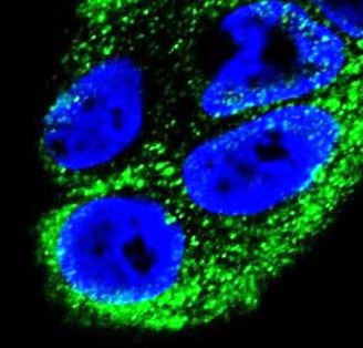 anti-ADH1B antibody (ARG55246) - arigo Biolaboratories